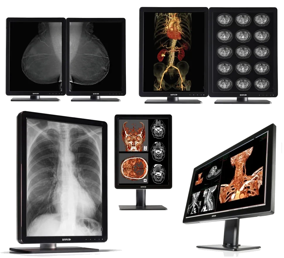 Barco medical imaging displays